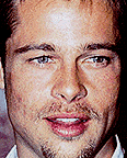 Brad Pitt Acne whole face
