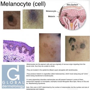 Melanocyte (Pigment cell)