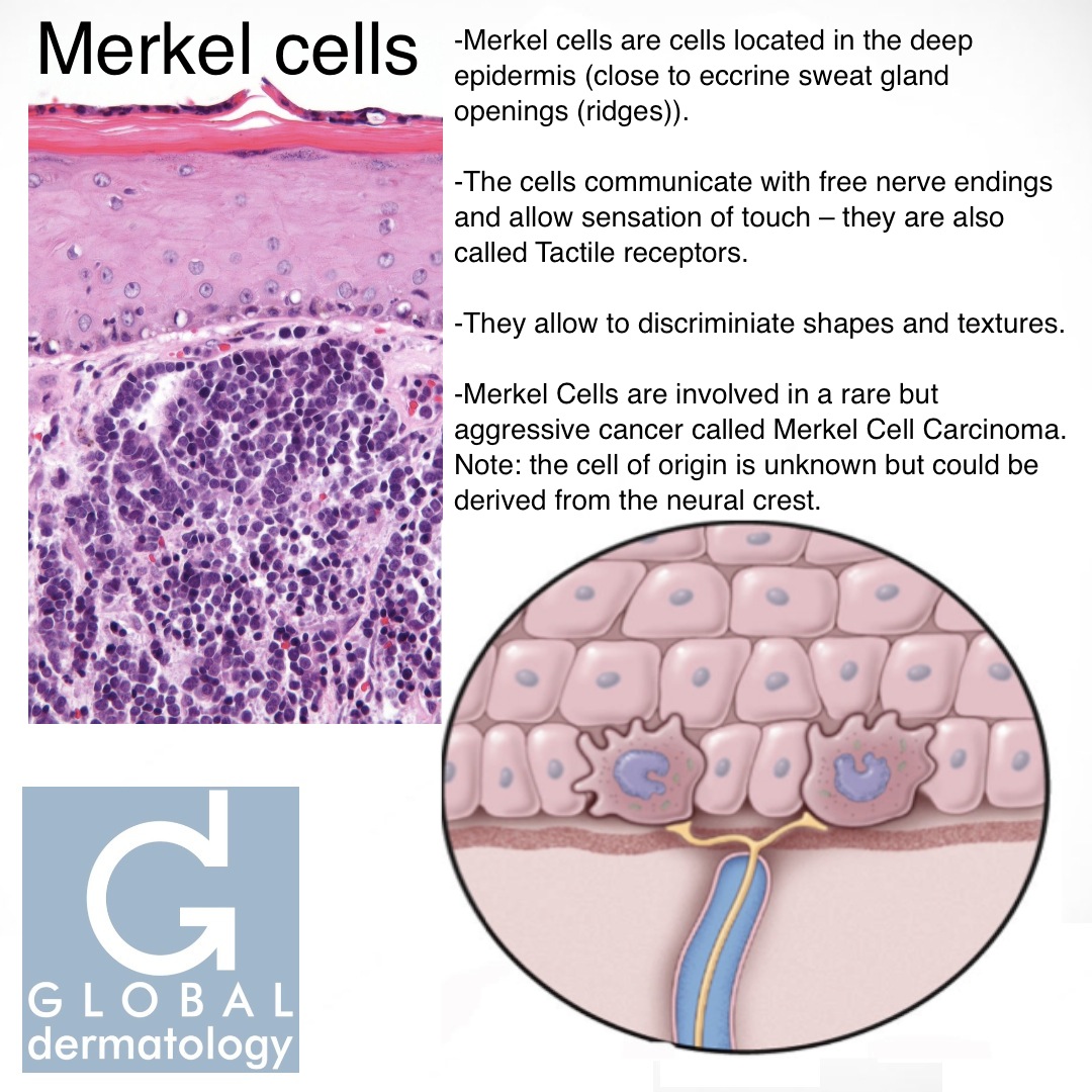 Global Dermatology Merkel Cell Instagram 