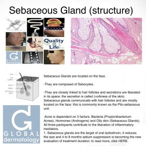 Sebaceous Gland