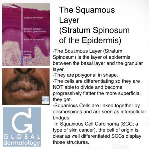 Squamous Layer (Stratum Spinosum)