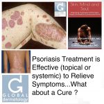 Psoriasis Treatment Is Effective (Topical Or Systemic) To Relieve Symptoms...What About A Cure ?