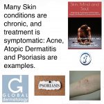 Many Skin Conditions Are Chronic AD And Psoriasis