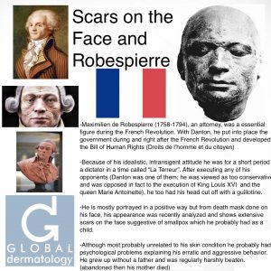 Robespierre and Scars on the Face (from Smallpox)