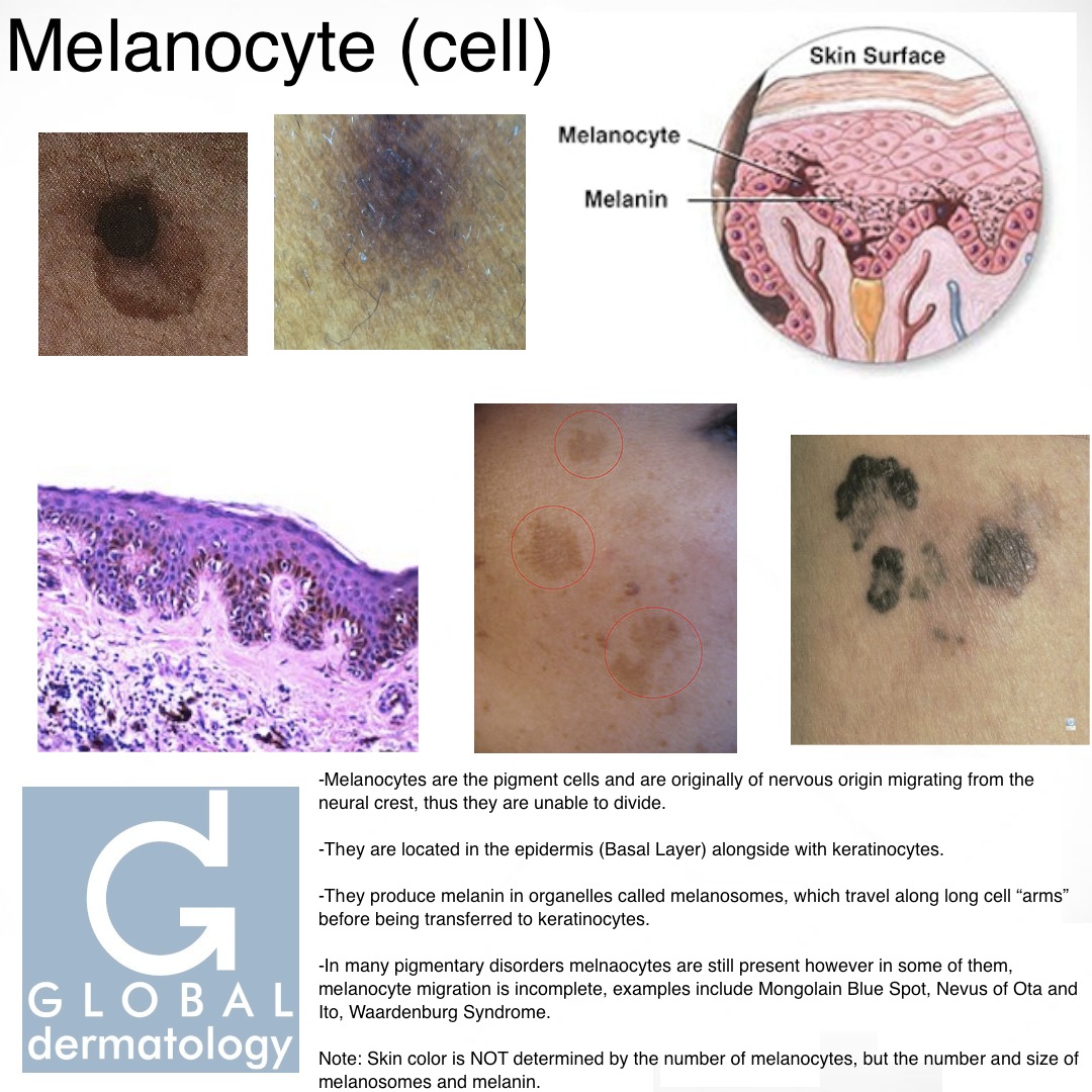 Global Dermatology » Melanocyte (cell) (Instagram)